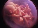 Almudi.org - Gemelos