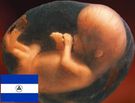 Almudi.org - Trinfo de la vida en Nicaragua
