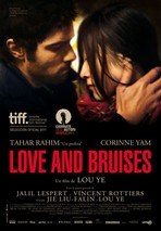 Love and bruises